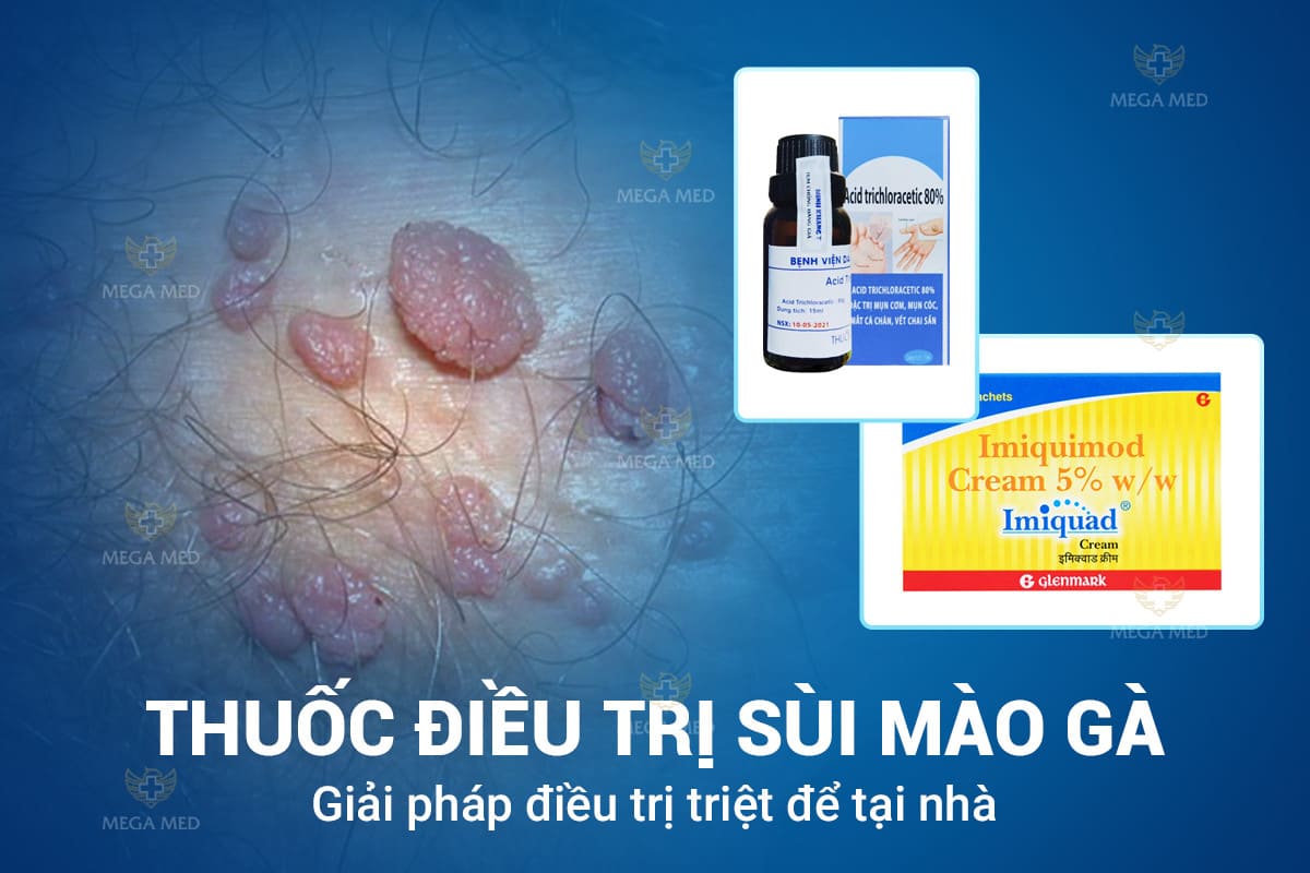 Thuốc điều trị sùi mào gà